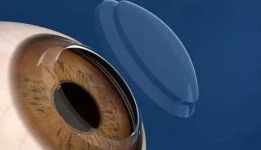 《角膜塑形用硬性透气接触镜说明书编写指导原则（2020年修订版）》
